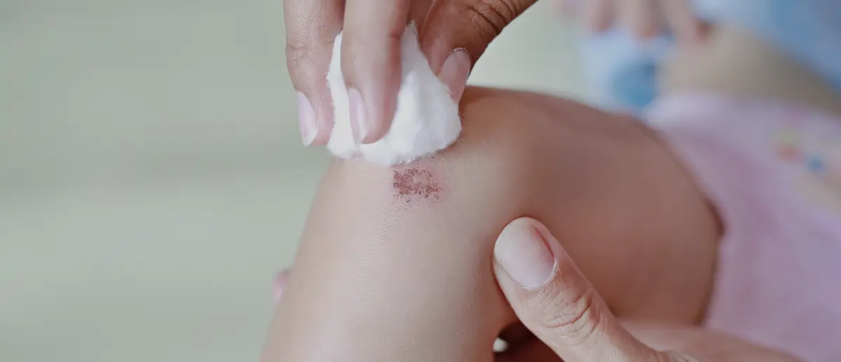 Упал, обжегся… победил!