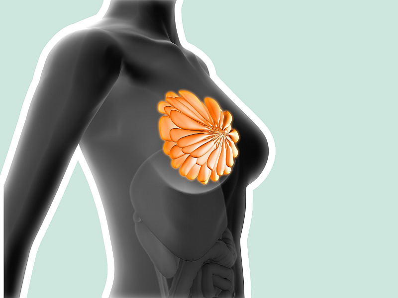 4 новых случая в минуту: почему рака груди все больше?