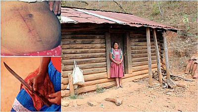 Она сама сделала себе кесарево