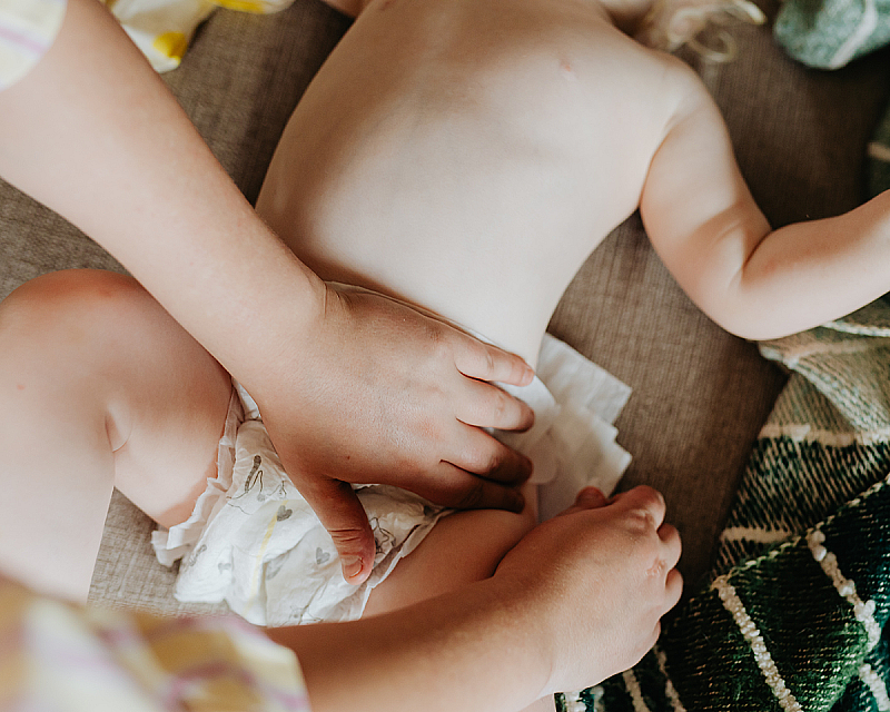 «Аллергия на подгузники» у детей: причины, симптомы и как избежать