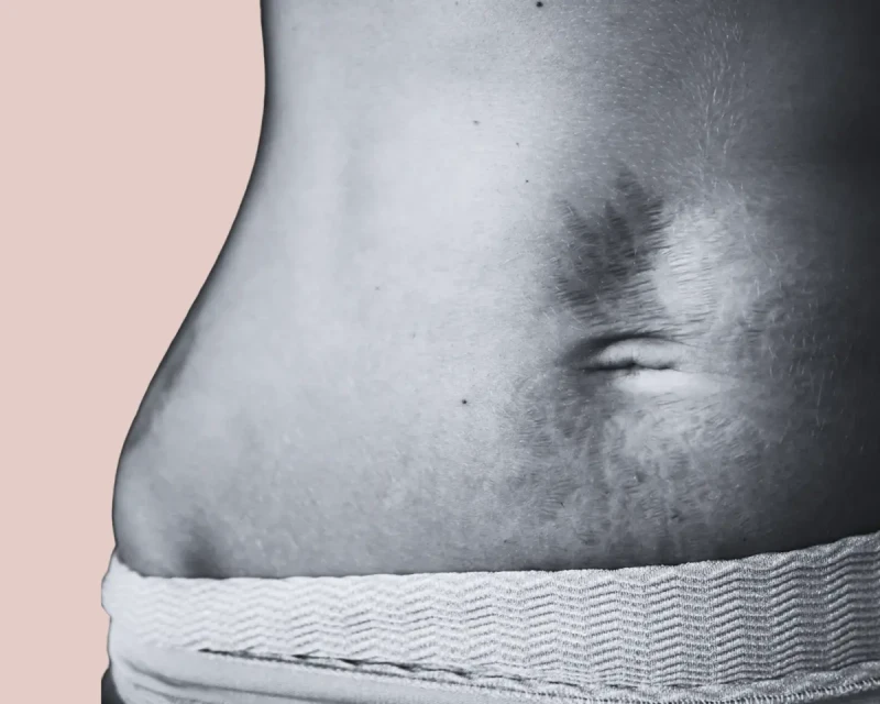 Тело после родов: почему нам так сложно принять себя — и что с этим делать на самом деле