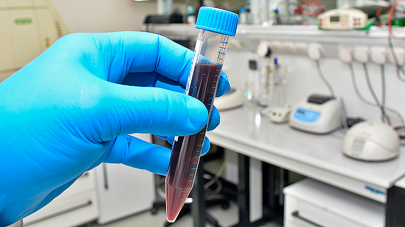 Анализ крови на гемосиндром