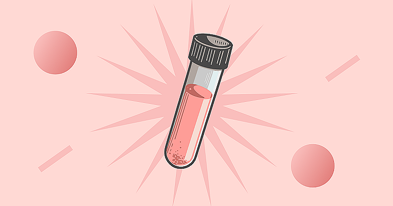 СОЭ при беременности