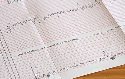 Полная расшифровка КТГ для беременных: подробное руководство