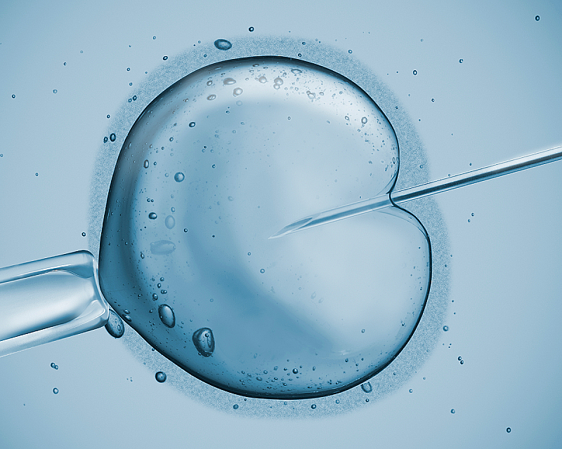 Инъекция сперматозоида ИКСИ
