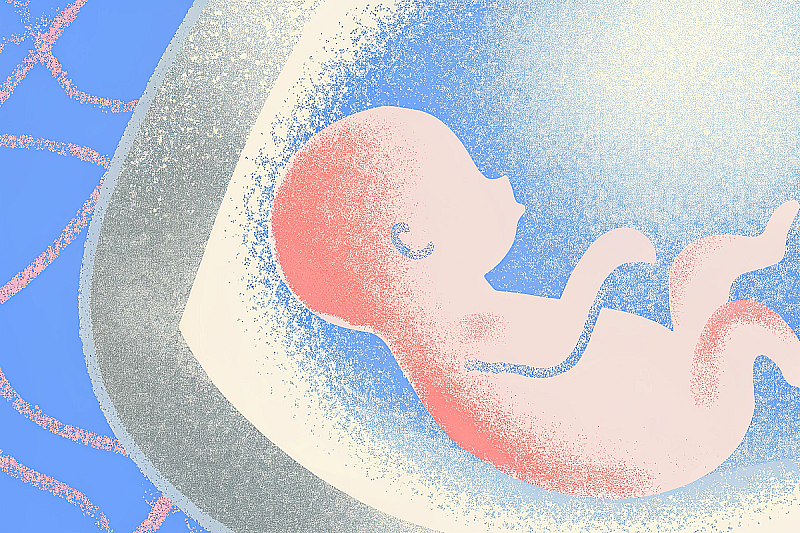 Положение плода