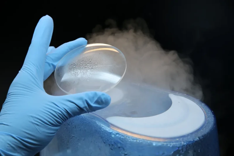 Всё о заморозке яйцеклеток в России: кому это нужно, как проходит процедура и можно ли сделать по ОМС