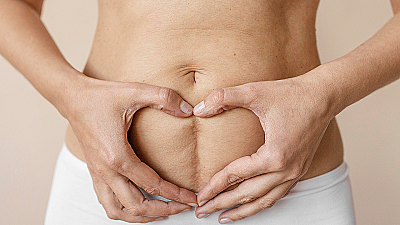 Как быстро восстановиться после кесарева