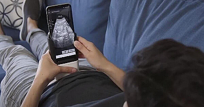 Беременные смогут делать УЗИ сами с помощью смартфона