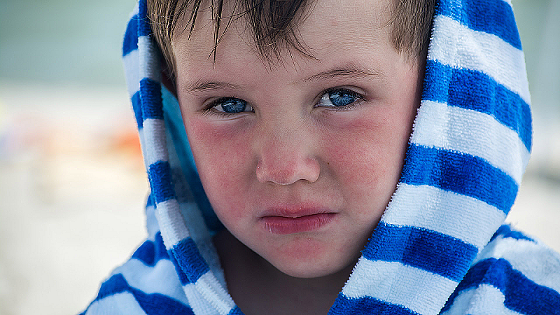 Можно ли загорать при атопическом дерматите?