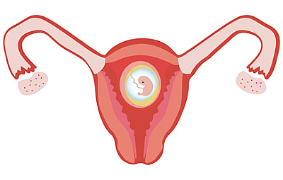 Процедура ЭКО