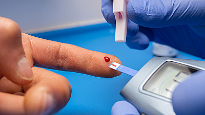 Норма для глюкозотолерантного теста при беременности