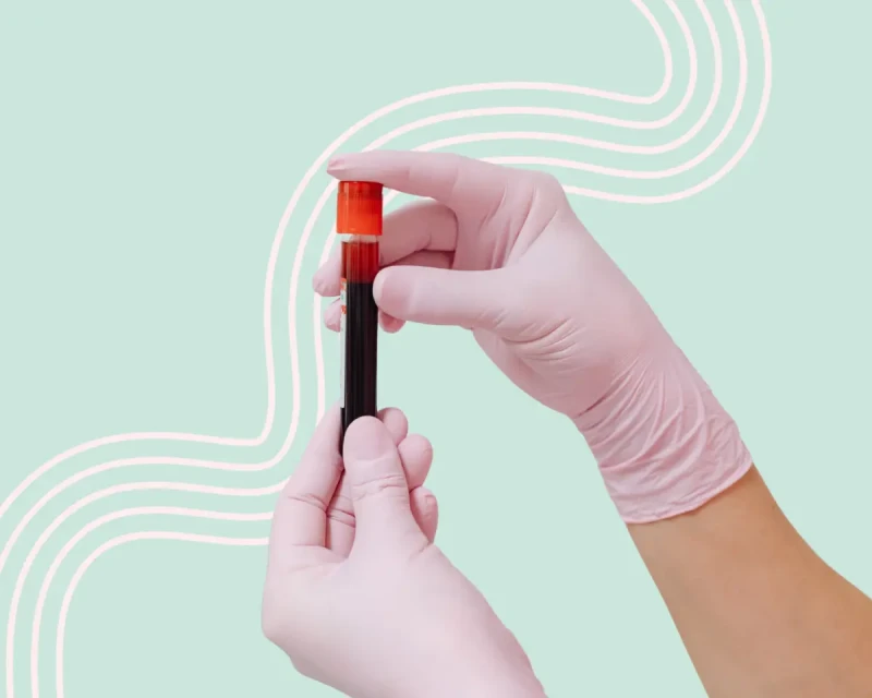 У каждой пятой москвички снижен овариальный резерв. А что это значит?