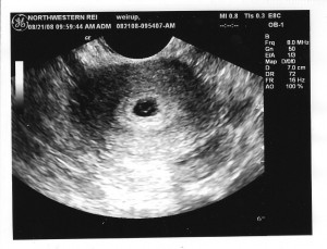 Подтверждение беременности 2 Подтверждение беременности 2